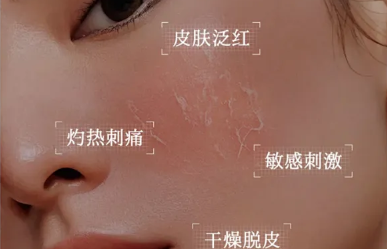 微肽生物——美容院专业线敏感肌修护产品源头供应厂家